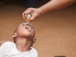 rougeole-et-rubeole-une-campagne-nationale-de-vaccination-de-rattrapage-ouverte-jusqu-au-11-decembre